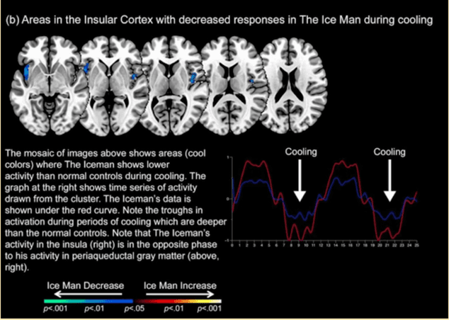 Brain scans and activity graphs show Wim Hof's (The Iceman) decreased insular cortex responses during cooling compared to normal controls.